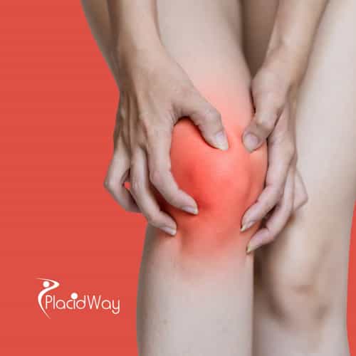 Stem Cell Therapy in Turkey for Rheumatoid Arthritis: Top Clinics and Benefits for Middle Eastern Patients